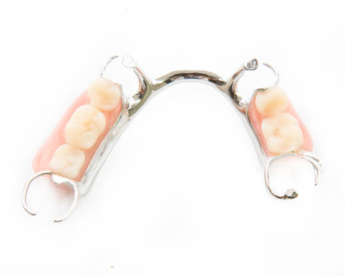 Partial Denture Options For Replacing Missing Teeth